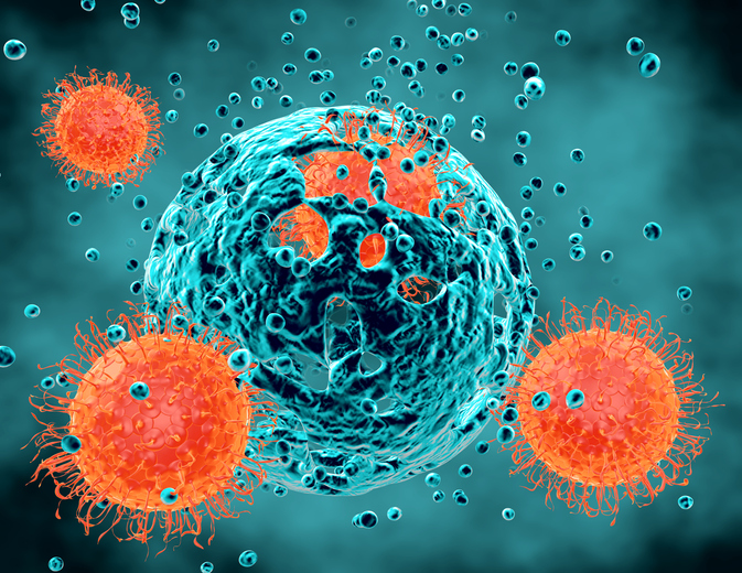 Stem cell transplant triggers HIV remission